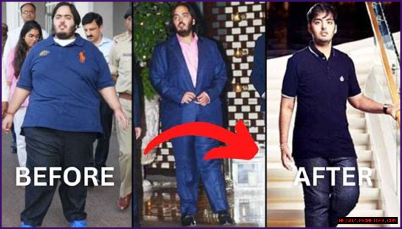 Anant Ambani: A Journey Through His Health History