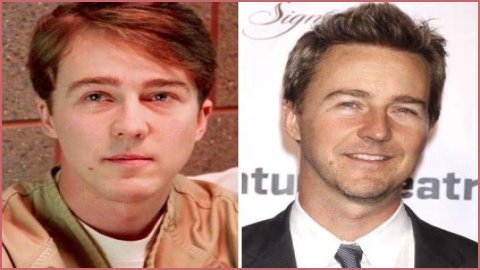 Edward Norton Plastic Surgery Before and After