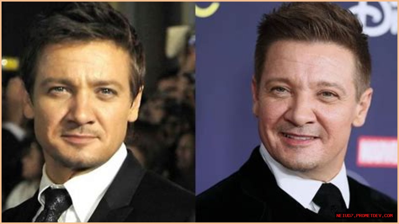 Jeremy Renner Plastic Surgery Before and After 