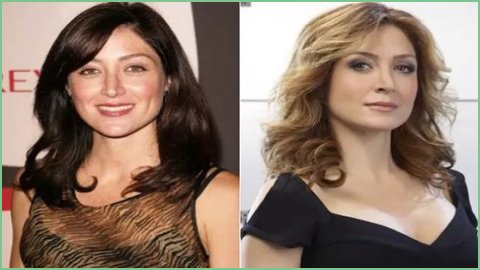 Sasha Alexander Plastic Surgery Before and After